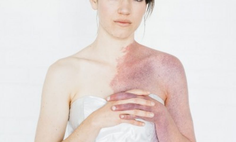 In This Skin - Patience