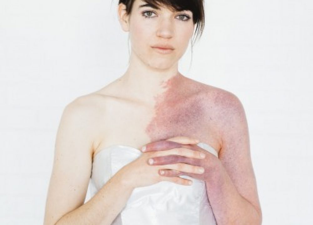 In This Skin - Patience